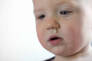Насморк у ребенка 3 года заложен нос thumbnail