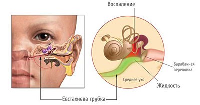 Внезапная заложенность носа и головокружение